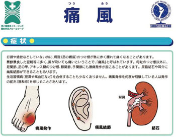 痛風